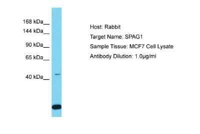 Western Blot: SPAG1 Antibody [NBP2-88340]