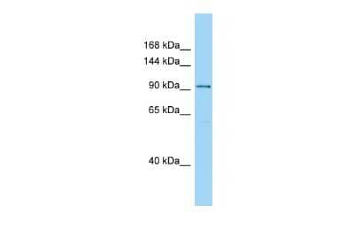 Western Blot: SPAG1 Antibody [NBP2-88341]