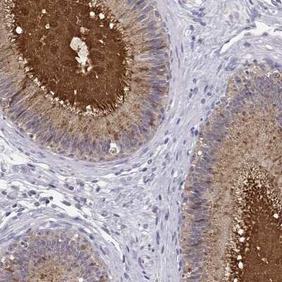 Immunohistochemistry: SPAG11B Antibody [NBP2-68597]