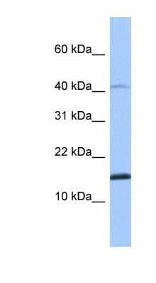 Western Blot: SPAG11B Antibody [NBP1-91448]