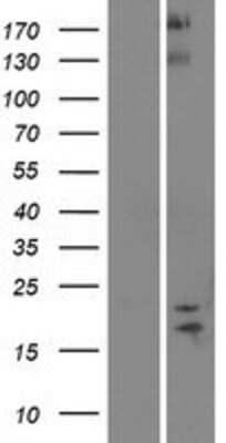 Western Blot: SPAG11B Overexpression Lysate [NBP2-05795]