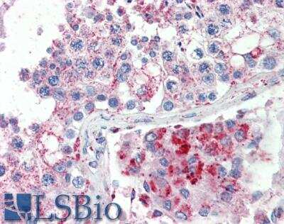 Immunohistochemistry-Paraffin: SPAG16 Antibody [NBP1-47220]