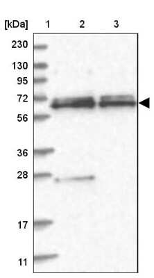 Western Blot: SPAG16 Antibody [NBP1-84124]