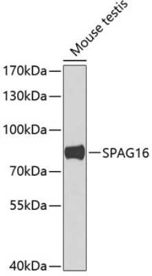 Western Blot: SPAG16 AntibodyBSA Free [NBP2-93205]