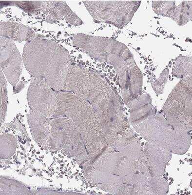 Immunohistochemistry-Paraffin: SPAG17 Antibody [NBP1-93840]