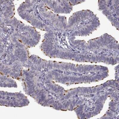 Immunohistochemistry-Paraffin: SPAG17 Antibody [NBP1-93841]
