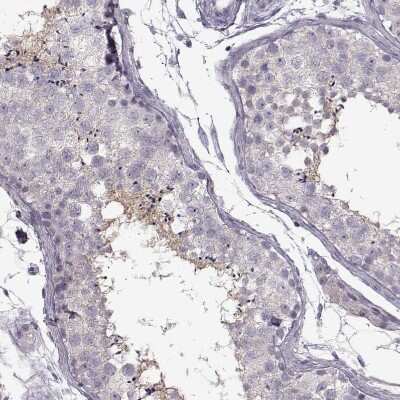 Immunohistochemistry-Paraffin: SPAG17 Antibody [NBP1-93841]