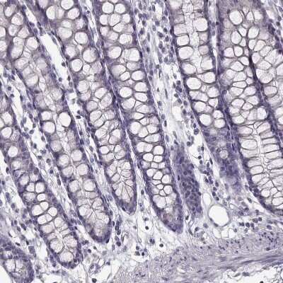 Immunohistochemistry-Paraffin: SPAG17 Antibody [NBP1-93841]