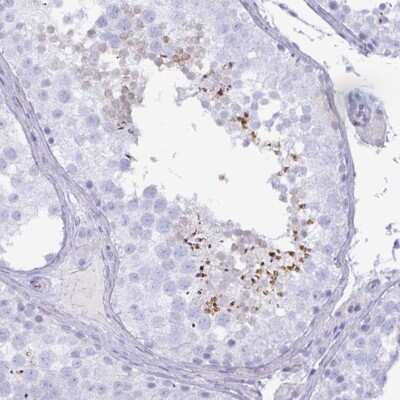 Immunohistochemistry-Paraffin: SPAG4 Antibody [NBP2-38937]