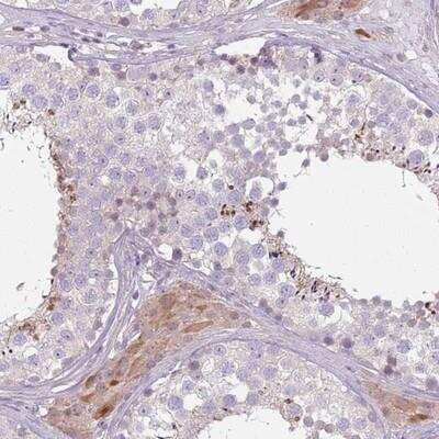 Immunohistochemistry-Paraffin: SPAG4 Antibody [NBP2-13367]