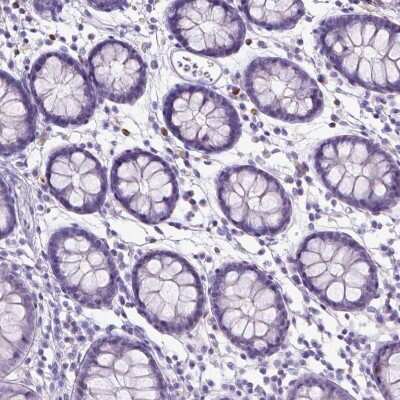 Immunohistochemistry-Paraffin: SPAG6 Antibody [NBP1-80923]