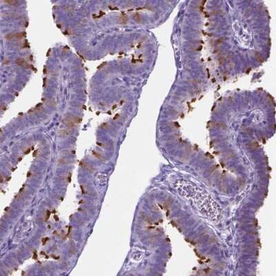 Immunohistochemistry-Paraffin: SPAG6 Antibody [NBP1-80923]
