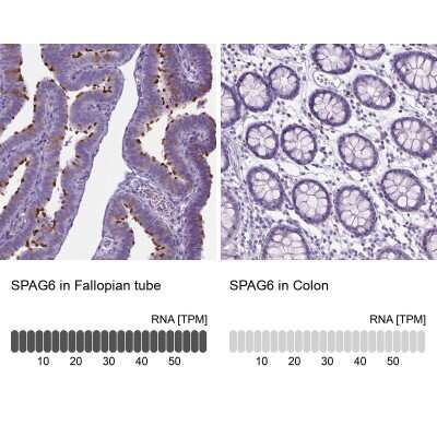 Immunohistochemistry-Paraffin: SPAG6 Antibody [NBP1-80923]