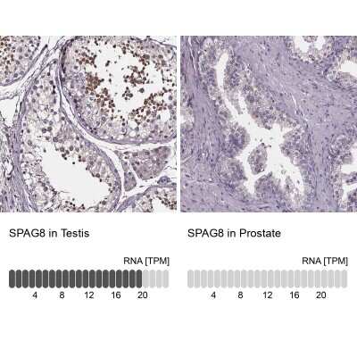 Immunohistochemistry-Paraffin: SPAG8 Antibody [NBP2-39092]