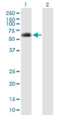 Western Blot: SPAG8 Antibody [H00026206-B01P]
