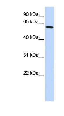 Western Blot: SPAG8 Antibody [NBP1-54628]