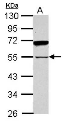 Western Blot: SPAG8 Antibody [NBP2-20464]