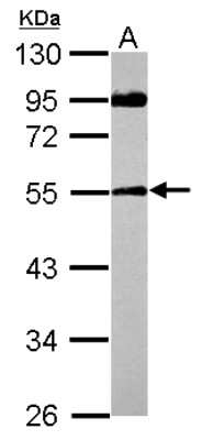 Western Blot: SPAG8 Antibody [NBP2-20465]