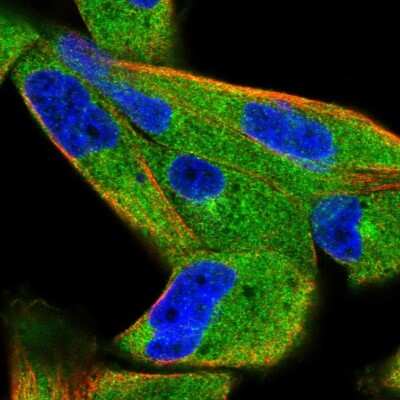 Immunocytochemistry/ Immunofluorescence: SPAG9 Antibody [NBP2-56914]