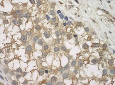 Immunohistochemistry: SPAG9 Antibody [NB100-79794]