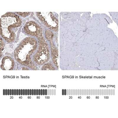 Immunohistochemistry-Paraffin: SPAG9 Antibody [NBP1-85393]