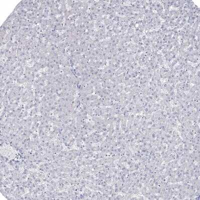 Immunohistochemistry-Paraffin: SPAG9 Antibody [NBP1-85393]