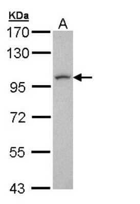 Western Blot: SPAG9 Antibody [NBP1-31153]