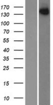 Western Blot: SPAG9 Overexpression Lysate [NBP2-07933]