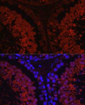 Immunocytochemistry/ Immunofluorescence: SPAM1 Antibody - Azide and BSA Free [NBP2-93736]