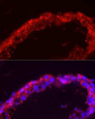 Immunocytochemistry/ Immunofluorescence: SPAM1 Antibody - Azide and BSA Free [NBP2-93736]
