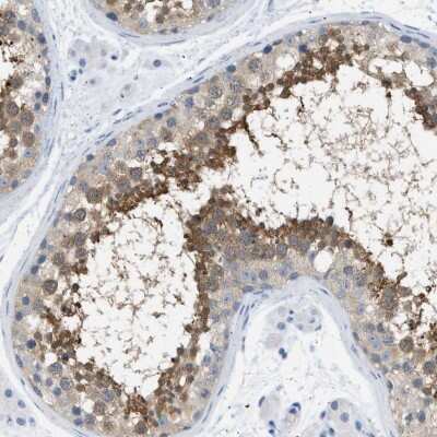 Immunohistochemistry-Paraffin: SPAM1 Antibody [NBP1-81637]