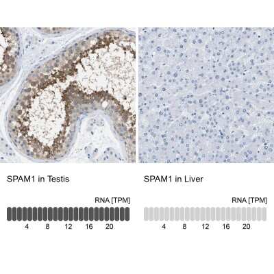 Immunohistochemistry-Paraffin: SPAM1 Antibody [NBP1-81637]