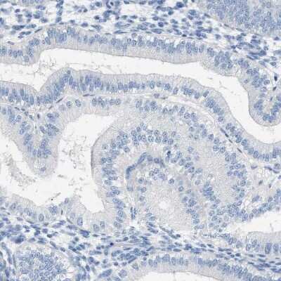Immunohistochemistry-Paraffin: SPAM1 Antibody [NBP1-81637]