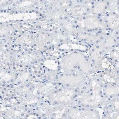 Immunohistochemistry-Paraffin: SPAM1 Antibody [NBP1-81637]