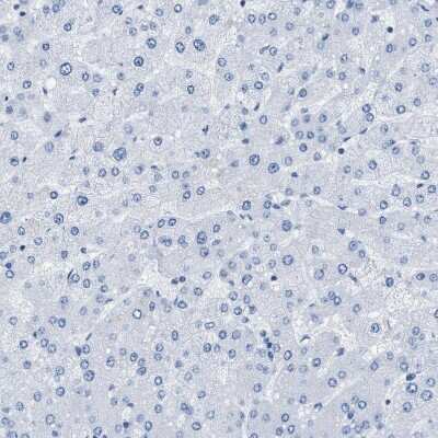 Immunohistochemistry-Paraffin: SPAM1 Antibody [NBP1-81637]