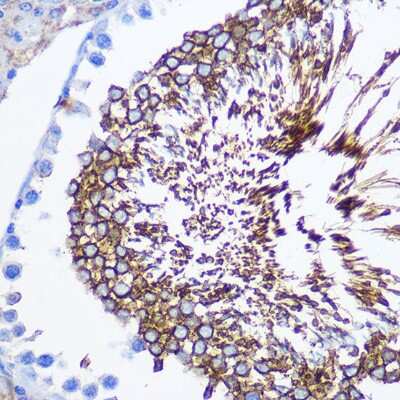 Immunohistochemistry-Paraffin: SPAM1 Antibody - Azide and BSA Free [NBP2-93736]