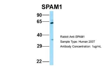 Western Blot: SPAM1 Antibody [NBP2-83579]