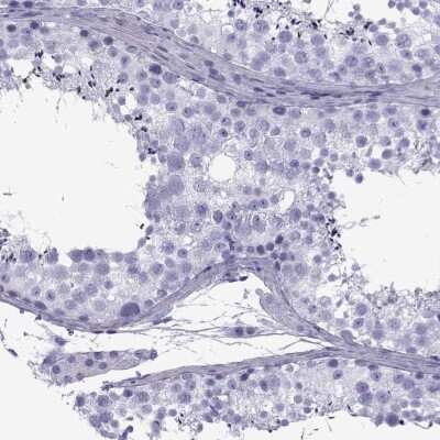 Immunohistochemistry: SPANX-D Antibody [NBP2-68961]