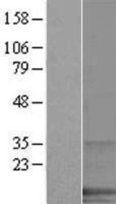 Western Blot: SPANXA1 Overexpression Lysate [NBP2-07406]