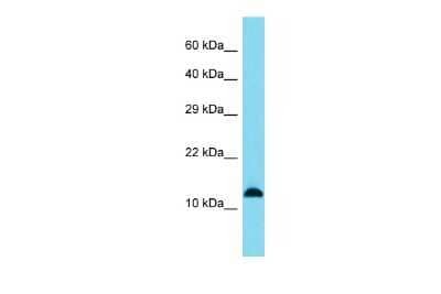 Western Blot: SPANXB1 Antibody [NBP2-84273]