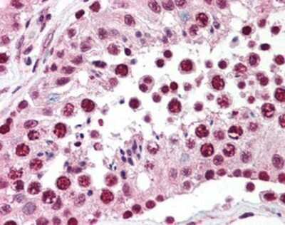 Immunohistochemistry-Paraffin: SPANXC Antibody - BSA Free [NBP1-03285]