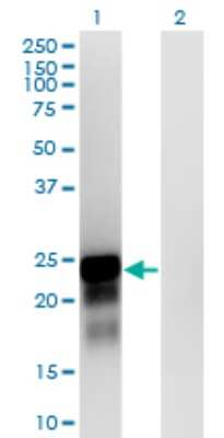 Western Blot: SPANXN3 Antibody (1F11) [H00139067-M01]