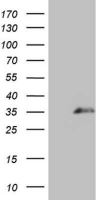 Western Blot: SPANXN3 Antibody (OTI4B1) [NBP2-45921]