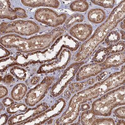 Immunohistochemistry-Paraffin: SPANXN4 Antibody [NBP1-94095]