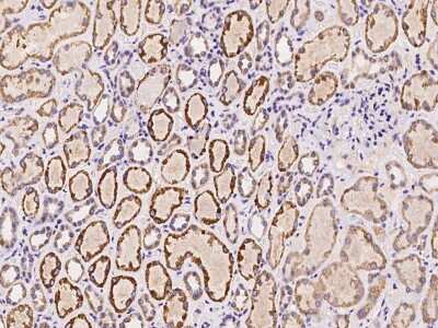 Immunohistochemistry-Paraffin: SPANXN4 Antibody [NBP2-98021]