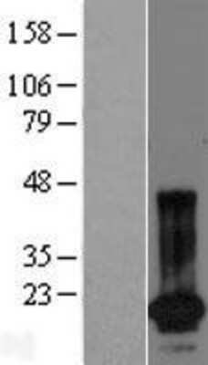 Western Blot: SPANXN4 Overexpression Lysate [NBP2-08708]