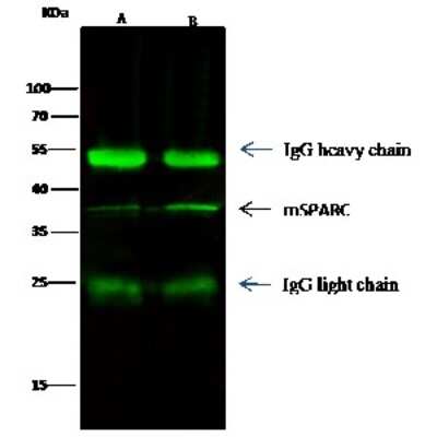 Immunoprecipitation: SPARC Antibody (001) [NBP2-90612]