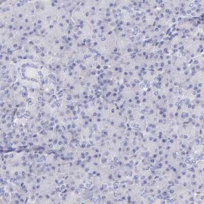 Immunohistochemistry-Paraffin: SPARC Antibody [NBP1-80971]