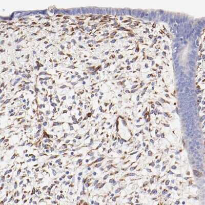 Immunohistochemistry-Paraffin: SPARC Antibody [NBP1-80971]