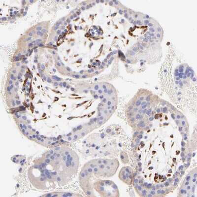 Immunohistochemistry-Paraffin: SPARC Antibody [NBP1-80971]